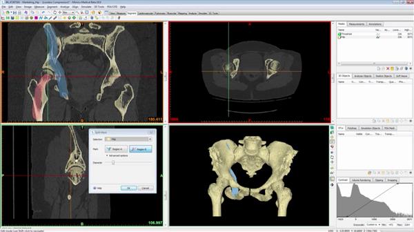 Mimics Innovation Suite Medical 20 Free Download