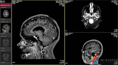 Dicom Portable Free Download