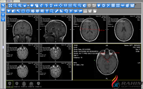  Dicom Portable Free Download