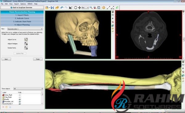 Materialise ProPlan CMF 3.0 Free Download