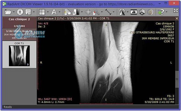 DICOM viewer free download