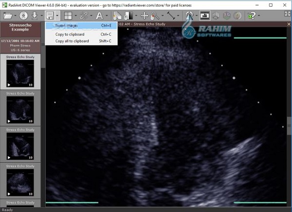 RadiAnt DICOM Viewer 2020.2