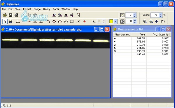 Digimizer Free Download