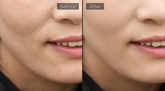 SkinFiner 4.2 PhotoShop Plugin
