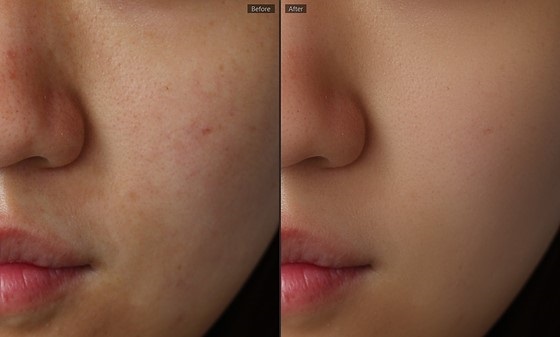SkinFiner PhotoShop Plugin Windows 10