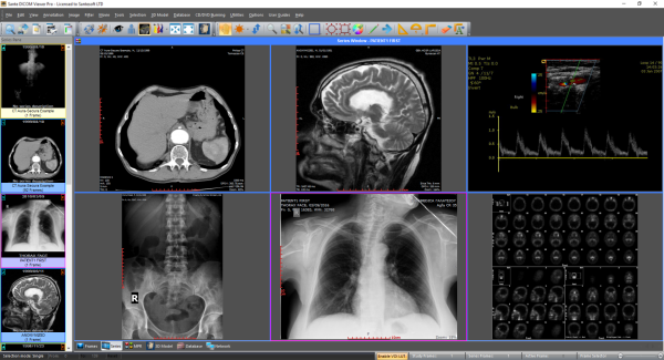 Sante DICOM Viewer download