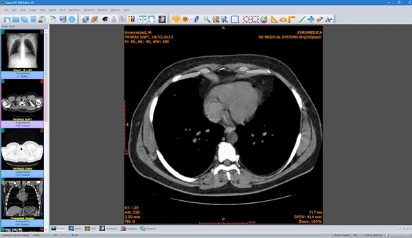 DICOM Editor tool free download