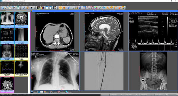 DVTk DICOM Editor download