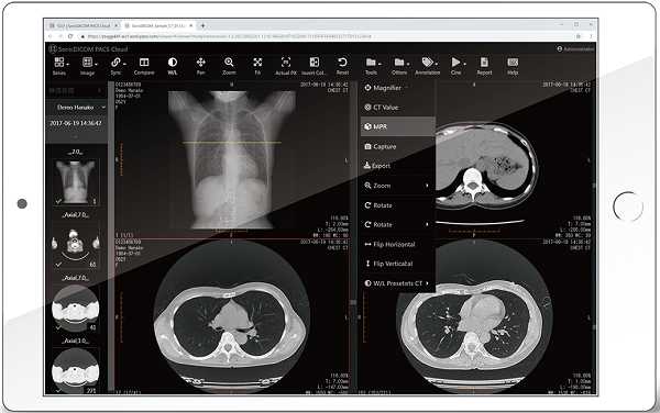 SonicDICOM PACS 3